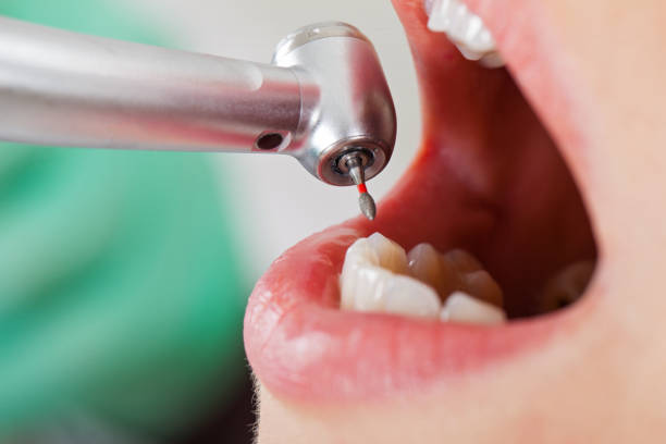 Best Emergency Gum Treatment in Essex Junction, VT